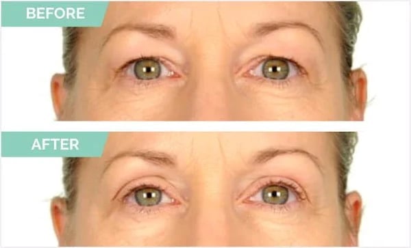 🏆HOT SALE-49%OFF🔥New Glue-Free Ultra Natural Invisible Double Eyelid Sticker
