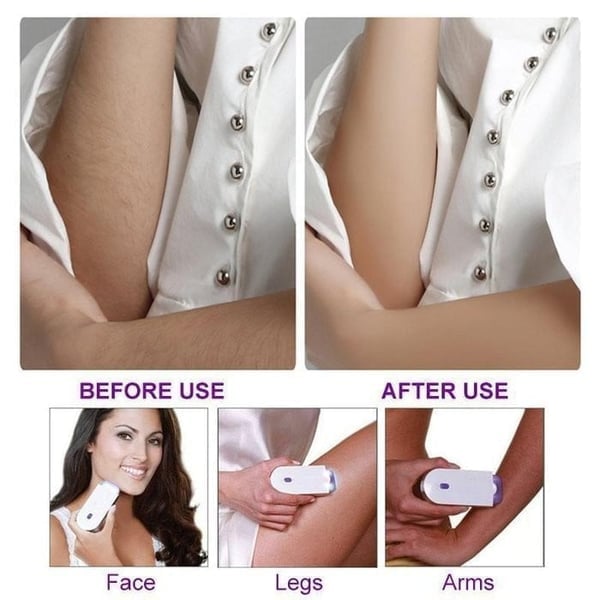 🔥BIG SALE - 47% OFF🔥 Silky Smooth Hair Eraser