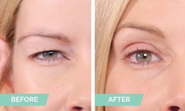 🏆HOT SALE-49%OFF🔥New Glue-Free Ultra Natural Invisible Double Eyelid Sticker