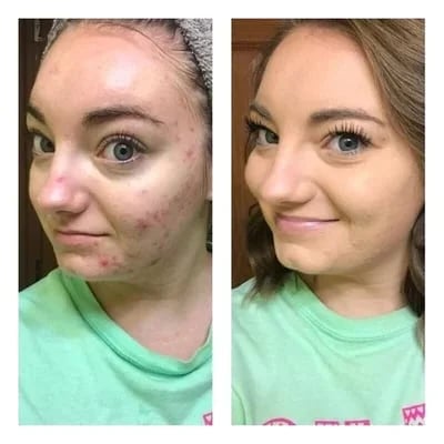 🔥 BIG SALE - 47% OFF🔥🎁Dreifarbiger Concealer - Feuchtigkeitsspendend und langanhaltend💦