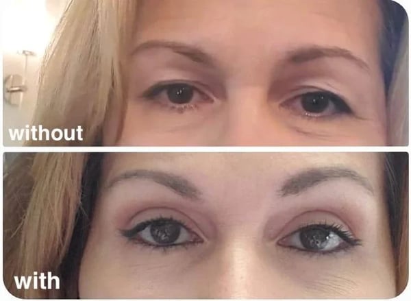 🏆HOT SALE-49%OFF🔥New Glue-Free Ultra Natural Invisible Double Eyelid Sticker